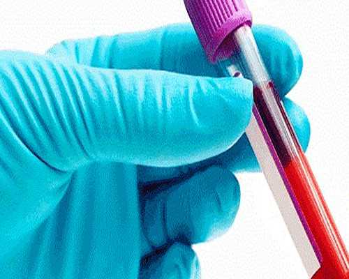 hpv慢性宫颈炎怎么治疗