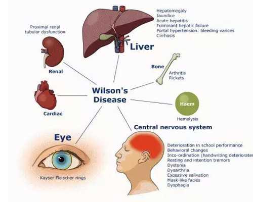 婆媳关系第一部电视剧全集