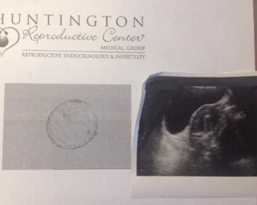 亲嘴了会不会怀孕初期