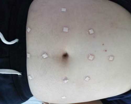 重庆做试管最好的医院排名公开，哪家医院做试管成功率最高？