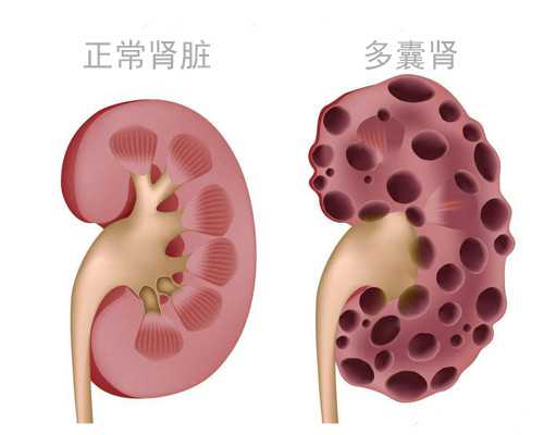 怀孕怎么看孕囊形状？看孕囊形状时需要注意什么？