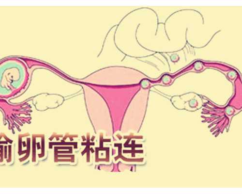 福州试管供卵生孩子,福州总院做试管婴儿一次成功的姐妹有吗？