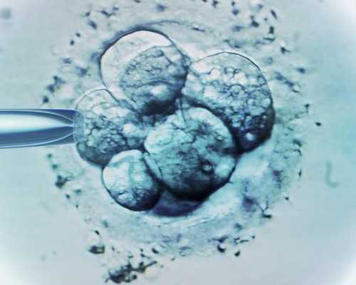 做试管福州那个医院好？试管婴儿福州哪家医院好？