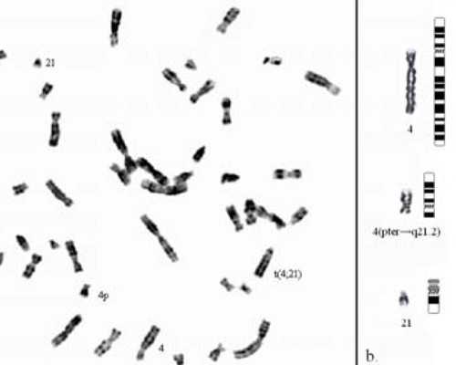 福州试管代怀供卵,福州三代试管婴儿价格是多少呢？